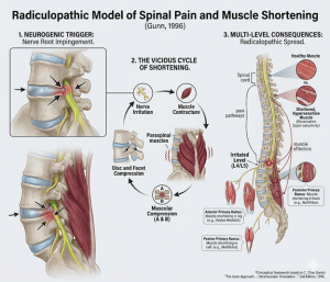 Pinched Nerve Muscle Trigger Points Compression Pain Cycle